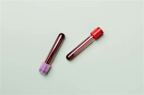 u&e blood test